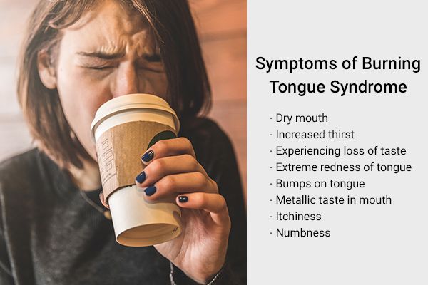 signs and symptoms indicative of burning tongue syndrome