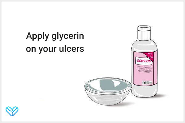 apply glycerine on your ulcers to aid relief from tongue soreness