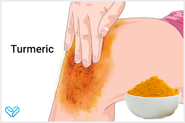 turmeric can be an effective remedy for chondromalacia patellae
