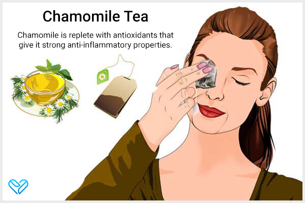 apply chamomile tea for allergic conjunctivitis