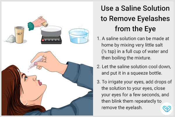 try using a saline solution to remove stuck eyelashes from your eyes